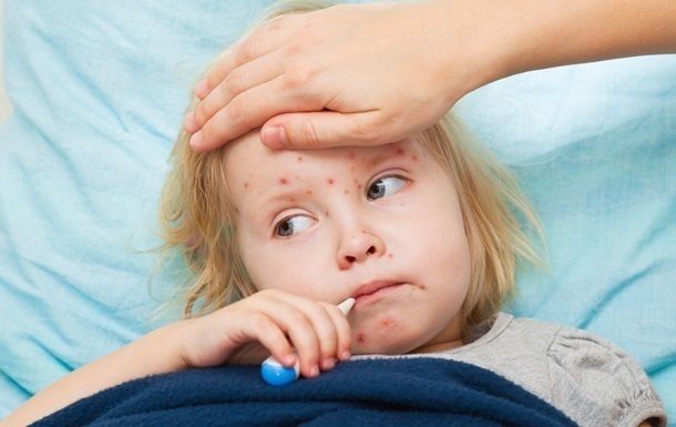 Заболеваемость корью в Украине выросла в разы