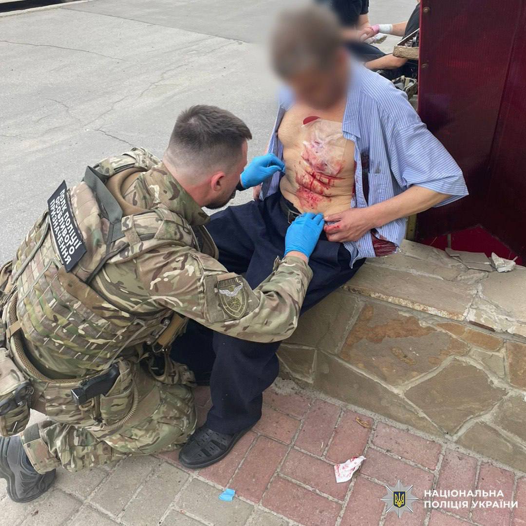 В Харькове уже более 40 раненых