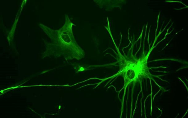 Ученые нашли лекарство от рассеянного склероза