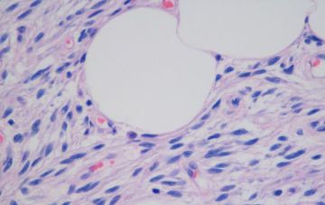 Создано нанолезвие для операций на клетках